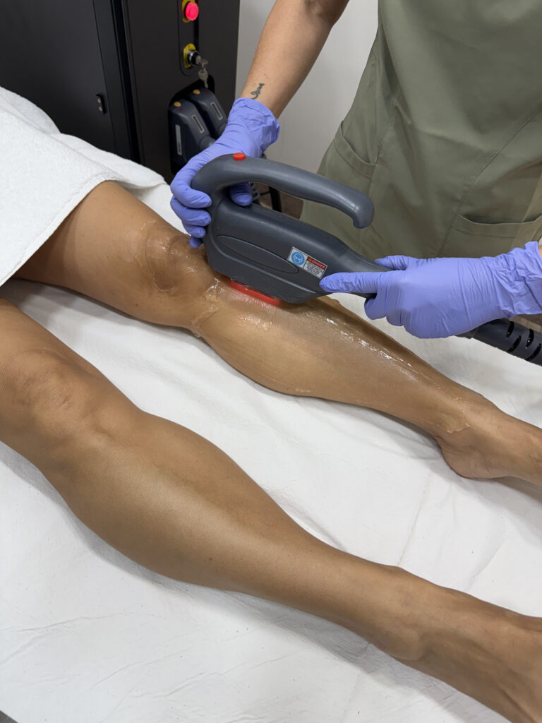 ¿Cuál es la diferencia entre IPL y fotodepilación tradicional?