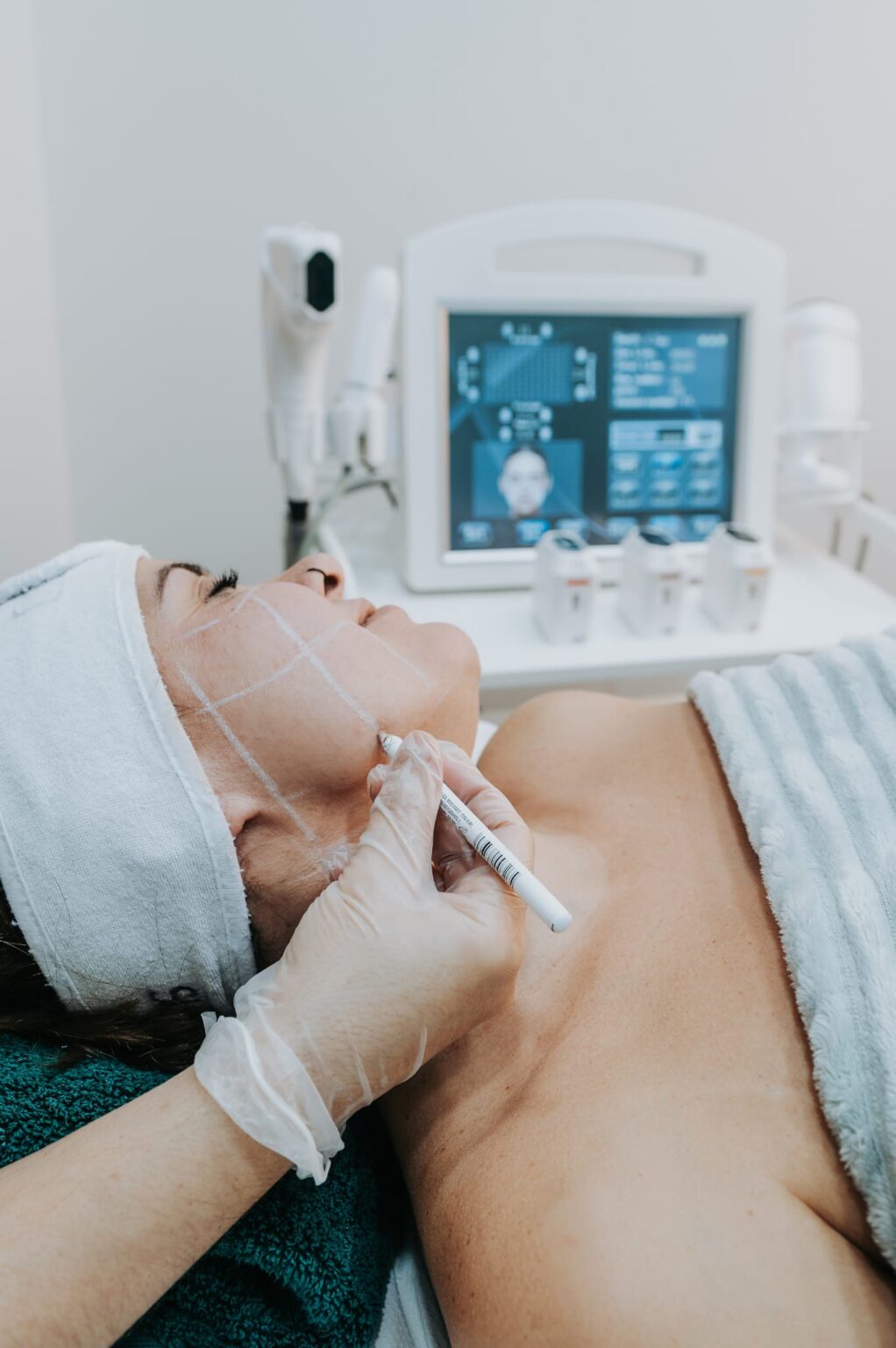 Diferencias entre IPL y HIFU 4D Barrido