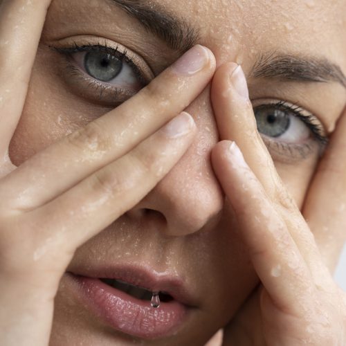 tratamiento ojeras (1)